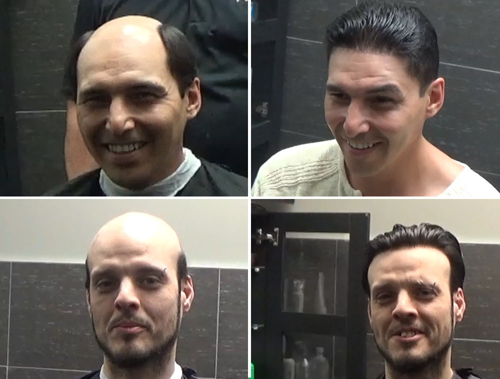 non surgical hair replacement Toronto, custom hair systems Toronto, hair replacement Toronto, Movie Hair Toronto, natural hair systems Toronto, non surgical hair restoration Toronto, lace hair systems Toronto, hairpieces Toronto, North York hair replacement, custom hairpieces Toronto, Hollywood hair replacement, New Roots Studios